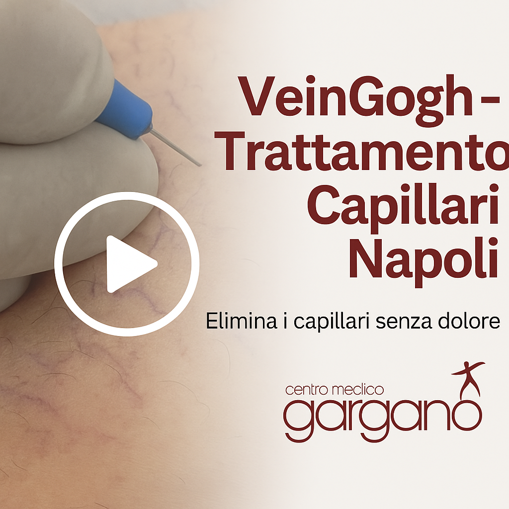 Trattamento capillari a Napoli con VeinGogh – Dottor Ciro Gargano