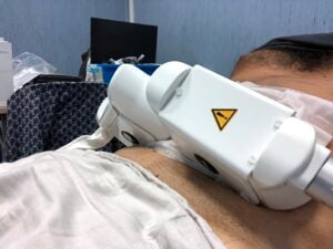 冷冻溶脂过程中放置于腹部的手具